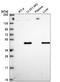 Ornithine aminotransferase, mitochondrial antibody, NBP2-56409, Novus Biologicals, Western Blot image 