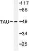 PHF-tau antibody, AP06347PU-N, Origene, Western Blot image 