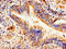Ald antibody, LS-C669685, Lifespan Biosciences, Immunohistochemistry paraffin image 