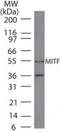 Melanocyte Inducing Transcription Factor antibody, MA5-16214, Invitrogen Antibodies, Western Blot image 