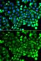 Neurocalcin Delta antibody, GTX65899, GeneTex, Immunofluorescence image 