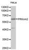 5 -AMP-activated protein kinase catalytic subunit alpha-2 antibody, abx000863, Abbexa, Western Blot image 