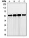 G3BP Stress Granule Assembly Factor 2 antibody, LS-C353209, Lifespan Biosciences, Western Blot image 