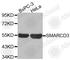 SWI/SNF-related matrix-associated actin-dependent regulator of chromatin subfamily D member 3 antibody, A2274, ABclonal Technology, Western Blot image 