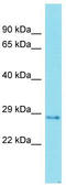 Family With Sequence Similarity 192 Member A antibody, TA335456, Origene, Western Blot image 