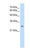 EBP Cholestenol Delta-Isomerase antibody, NBP1-59782, Novus Biologicals, Western Blot image 