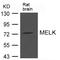 Maternal Embryonic Leucine Zipper Kinase antibody, A04038-1, Boster Biological Technology, Western Blot image 