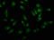 Ubiquitously Transcribed Tetratricopeptide Repeat Containing, Y-Linked antibody, LS-C671524, Lifespan Biosciences, Immunofluorescence image 