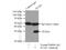 Snail Family Transcriptional Repressor 1 antibody, 13099-1-AP, Proteintech Group, Immunoprecipitation image 