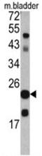 Sm22 antibody, AP17773PU-N, Origene, Western Blot image 