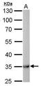 Malate dehydrogenase, mitochondrial antibody, TA308153, Origene, Western Blot image 