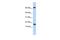 Chromosome 4 Open Reading Frame 46 antibody, GTX45841, GeneTex, Western Blot image 
