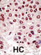 Ubiquitination Factor E4B antibody, 61-075, ProSci, Immunohistochemistry paraffin image 