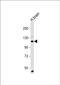 ATPase Na+/K+ Transporting Subunit Alpha 4 antibody, PA5-72353, Invitrogen Antibodies, Western Blot image 