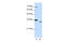 Proteasome Subunit Alpha 1 antibody, 29-294, ProSci, Enzyme Linked Immunosorbent Assay image 