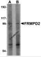 FERM And PDZ Domain Containing 2 antibody, 5455, ProSci, Western Blot image 
