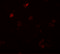Coiled-Coil Domain Containing 22 antibody, 6933, ProSci, Immunofluorescence image 
