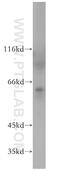 Mannosyl (Beta-1,4-)-Glycoprotein Beta-1,4-N-Acetylglucosaminyltransferase antibody, 17869-1-AP, Proteintech Group, Western Blot image 