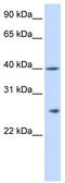 Glutathione S-transferase kappa 1 antibody, TA333788, Origene, Western Blot image 