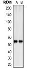SH2 domain-containing adapter protein B antibody, MBS820738, MyBioSource, Western Blot image 
