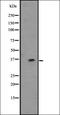 Keratin 2 antibody, orb337804, Biorbyt, Western Blot image 