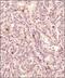 Survivin antibody, NBP2-59503, Novus Biologicals, Immunohistochemistry paraffin image 