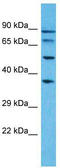 Pseudouridine Synthase 7 Like antibody, TA331702, Origene, Western Blot image 