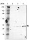 Chromosome X Open Reading Frame 21 antibody, NBP1-82317, Novus Biologicals, Western Blot image 