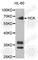 HCK Proto-Oncogene, Src Family Tyrosine Kinase antibody, A2083, ABclonal Technology, Western Blot image 