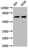 Plastin 1 antibody, CSB-PA623928LA01HU, Cusabio, Western Blot image 
