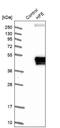 Homeostatic Iron Regulator antibody, NBP1-83250, Novus Biologicals, Western Blot image 