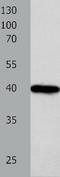 Forkhead Box L1 antibody, TA322641, Origene, Western Blot image 