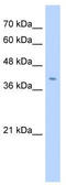 Fibronectin Type III Domain Containing 3B antibody, TA338617, Origene, Western Blot image 