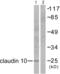 Claudin 10 antibody, abx013039, Abbexa, Western Blot image 