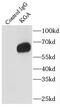 Glutaminase antibody, FNab04520, FineTest, Immunoprecipitation image 