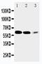 Solute Carrier Family 1 Member 6 antibody, PA2243, Boster Biological Technology, Western Blot image 
