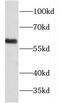 Flavin Containing Dimethylaniline Monoxygenase 5 antibody, FNab03170, FineTest, Western Blot image 