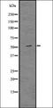 BIRC3 antibody, orb336700, Biorbyt, Western Blot image 
