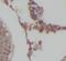 Phospholipase A2 Group IVB antibody, FNab10095, FineTest, Immunohistochemistry paraffin image 