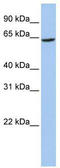 Solute carrier family 13 member 2 antibody, TA333984, Origene, Western Blot image 