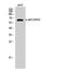 Tumor Protein P63 antibody, A00167S455, Boster Biological Technology, Western Blot image 