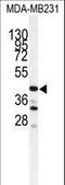 Cathepsin S antibody, LS-B12175, Lifespan Biosciences, Western Blot image 