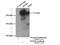 M6PR antibody, 20253-1-AP, Proteintech Group, Immunoprecipitation image 