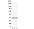 Major Histocompatibility Complex, Class II, DM Beta antibody, R30885, NSJ Bioreagents, Western Blot image 