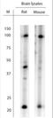 Leucine Rich Repeat And Ig Domain Containing 1 antibody, NBP1-46335, Novus Biologicals, Western Blot image 