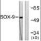 SRY-Box 9 antibody, orb94914, Biorbyt, Western Blot image 