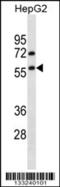 E3 ubiquitin-protein ligase TRIM13 antibody, 56-969, ProSci, Western Blot image 
