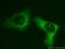 Eukaryotic translation initiation factor 3 subunit M antibody, 11423-1-AP, Proteintech Group, Immunofluorescence image 