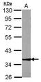 Zinc Finger Protein 396 antibody, GTX117367, GeneTex, Western Blot image 