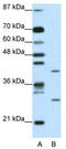 ZFP36 Ring Finger Protein Like 1 antibody, TA333956, Origene, Western Blot image 